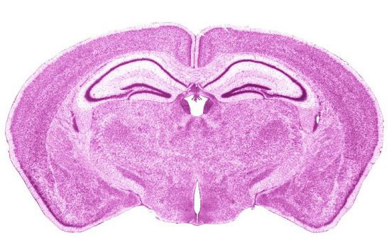 Shematic Of Mouse Brain Coronal Section